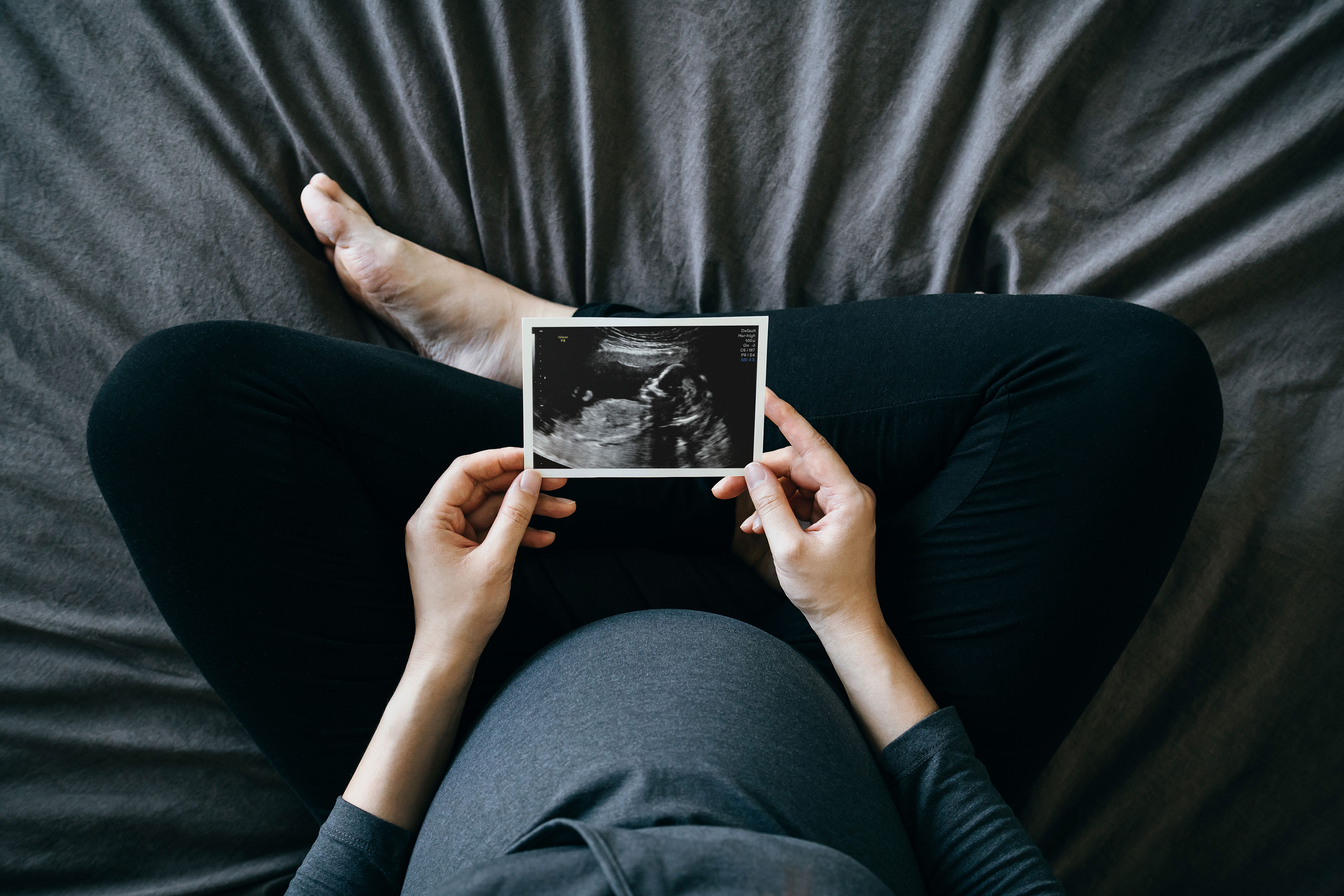 As US Birth Rate Falls, Feds’ Response May Make Pregnancy More Dangerous