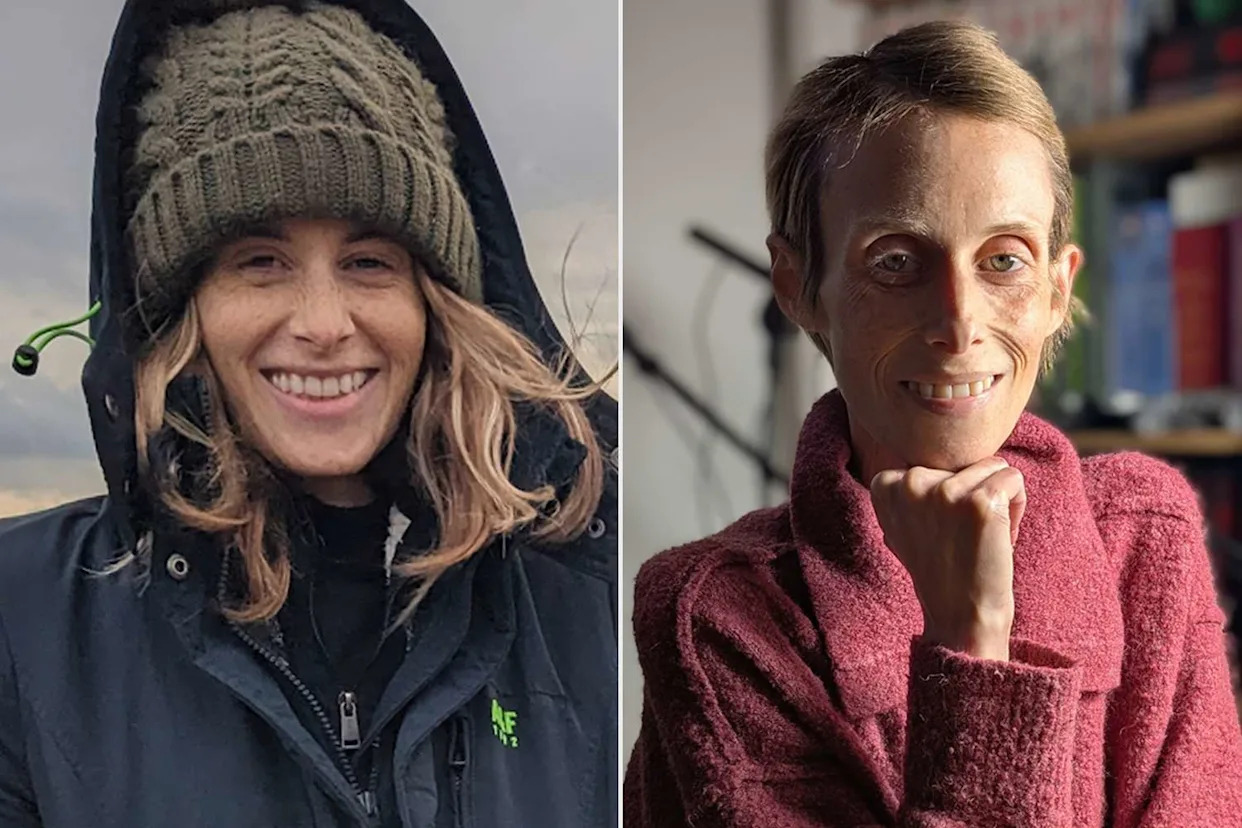 Man Documents Late Wife's Decline from Cancer in Heart-Wrenching Photos: 'She Aged in Fast Forward' (Exclusive)