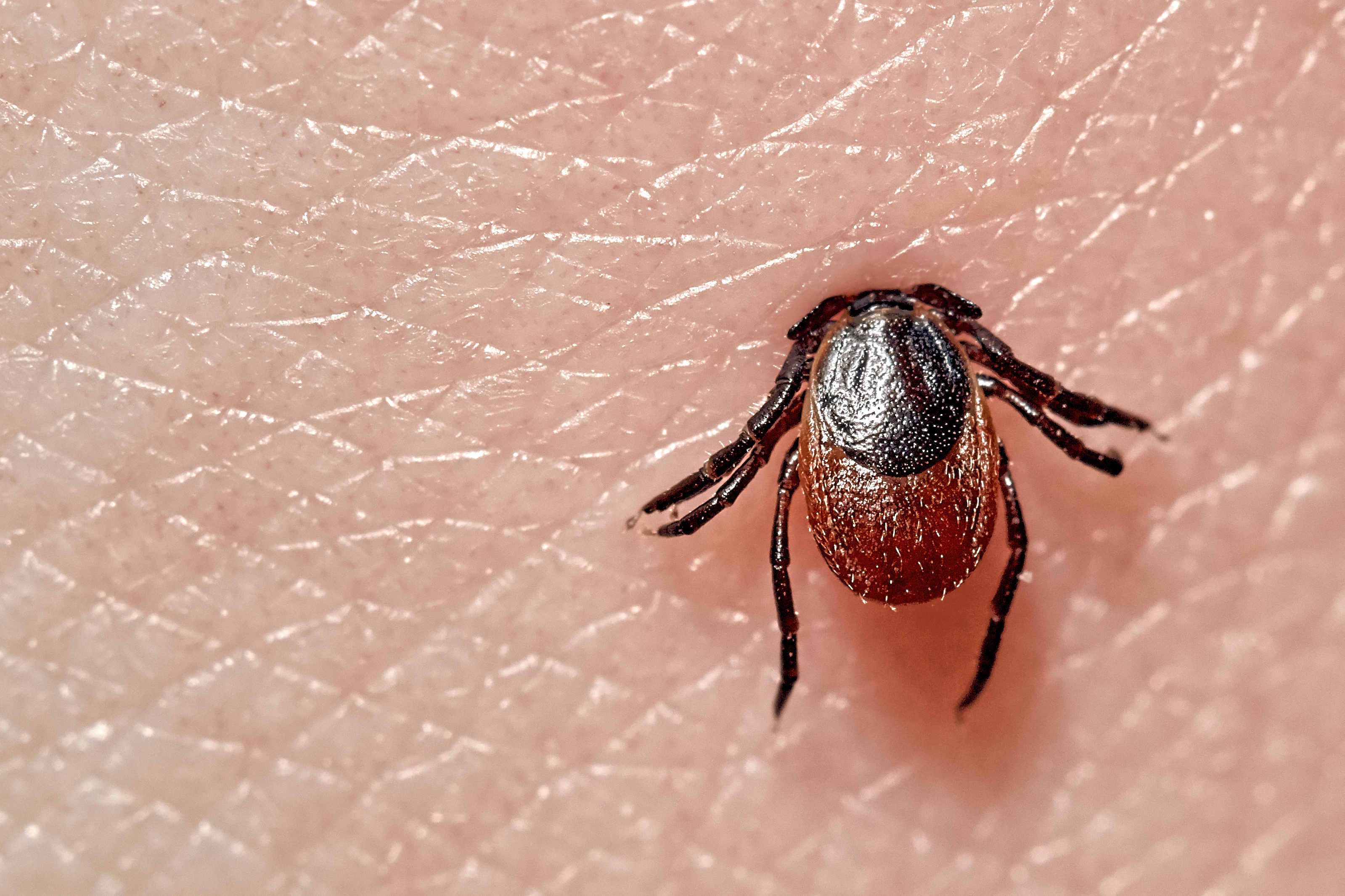 Meat allergies, confusion, vomiting — 5 diseases you can get from ticks as ER visits spike