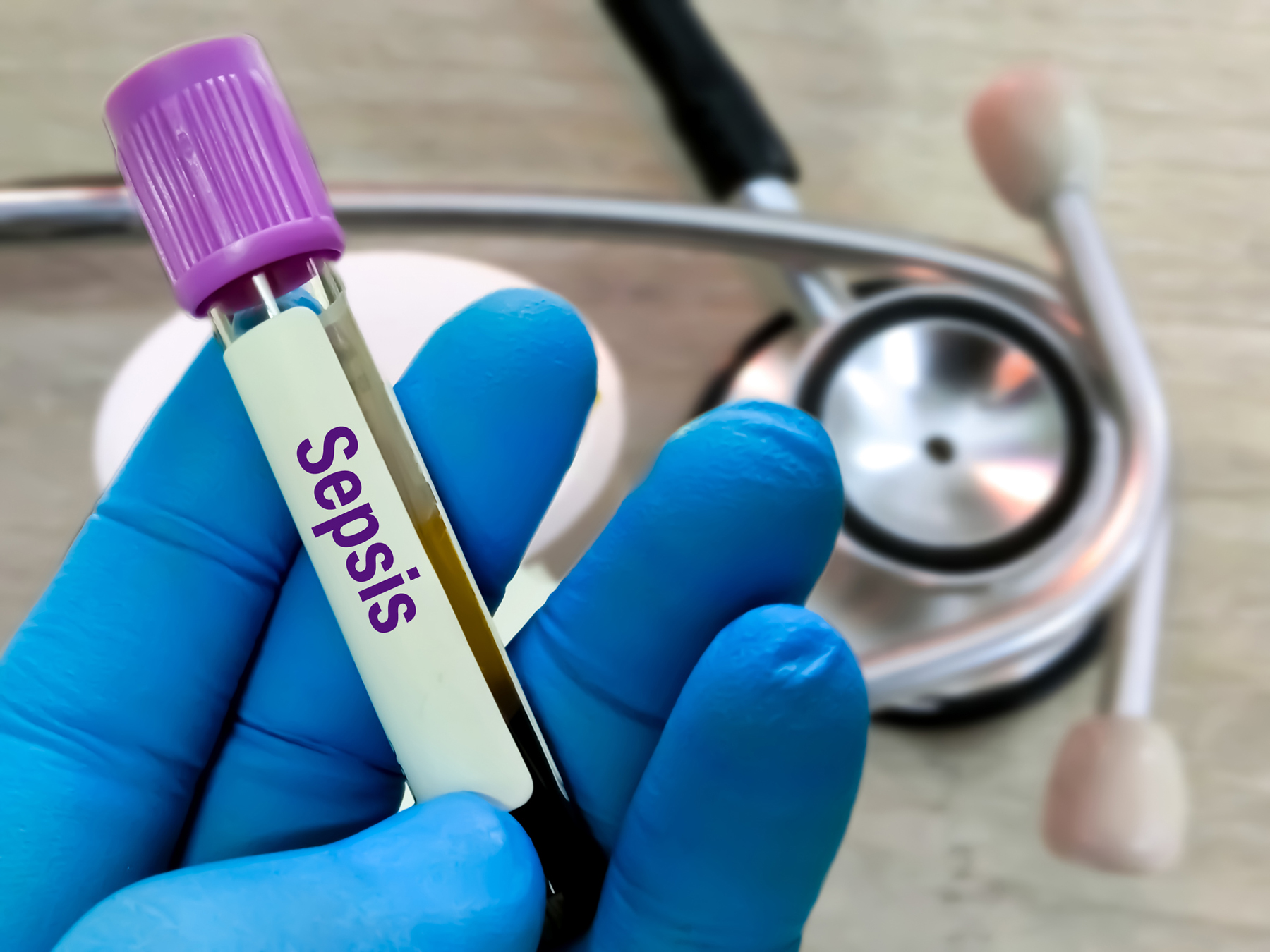 NASCAR driver’s death brings attention to sepsis; postpartum cardiovascular care; Ebola treatment; plus other stories with Vanderbilt Health sources