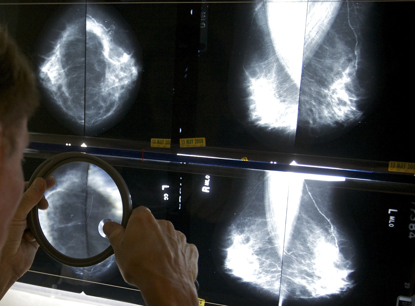 National Cancer Survivors Day highlights life after treatment