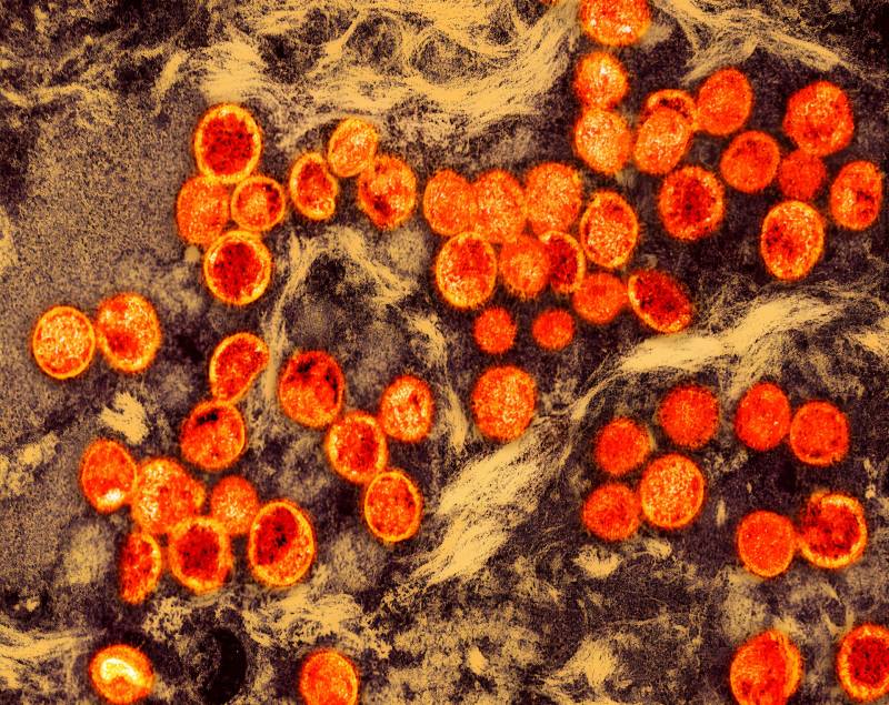 San Francisco Reports Its First Clade I Mpox Case — What to Know and How to Find a Vaccine