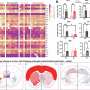 Study finds non-hallucinogenic psilocybin neural receptor: A novel target for treating depression and anxiety