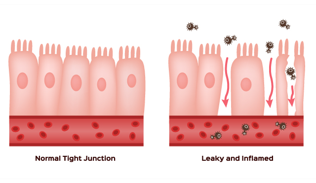 Study: Natural protein REELIN could repair leaky gut and alleviate depression