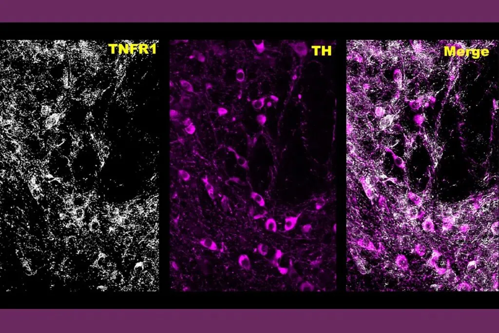 Unexpected UF finding could offer new treatment for meth addiction