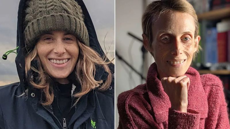 Man Documents Late Wife's Decline from Cancer in Heart-Wrenching Photos: 'She Aged in Fast Forward' (Exclusive)