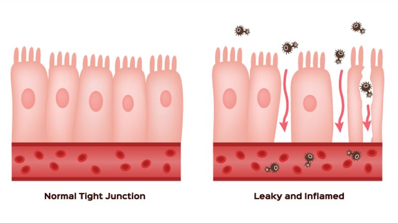 Study: Natural protein REELIN could repair leaky gut and alleviate depression