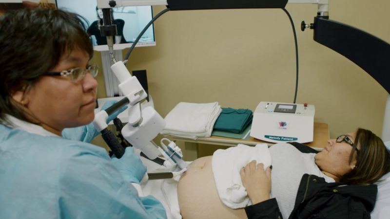 Alabama’s ‘Pretty Cool’ Plan for Robots in Maternity Care Sparks Debate
