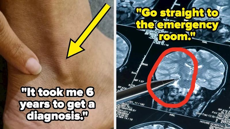 23 Symptoms People Wish They Paid Attention To Sooner