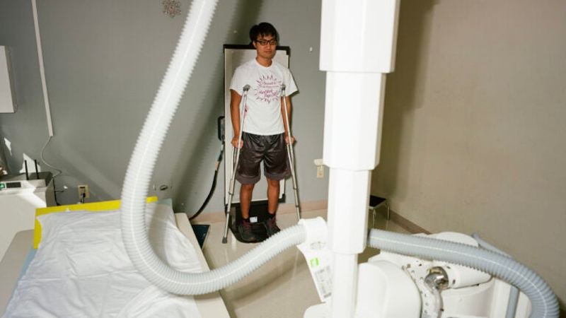 ‘I’d like to be normal’: Can height surgery make them happy?