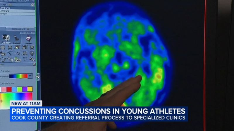 New effort to prevent concussions, CTE for student athletes in Cook County