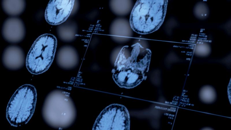Psychiatrists’ Use of Biomarkers Could Open a New Window Into Mental Health Diagnoses