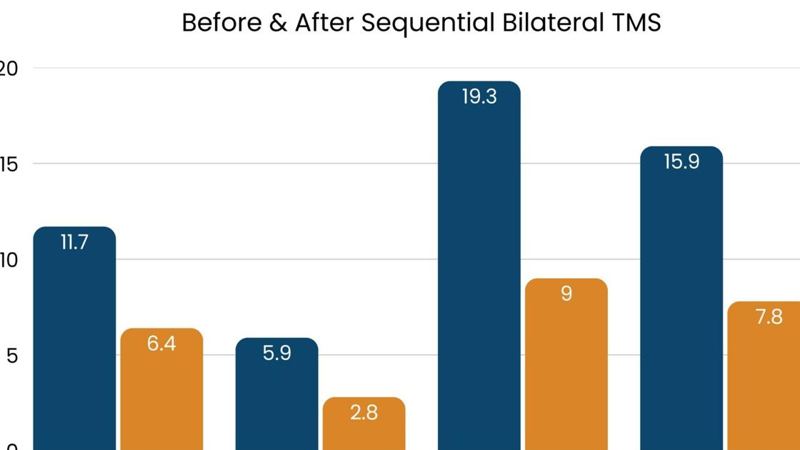 Sequential Bilateral TMS Protocol Offers Durable Relief for PTSD Patients