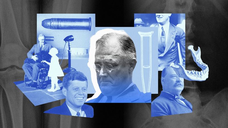 It’s Not Just Donald Trump — The White House Has Been Hiding Presidents’ Health Issues For Over 100 Years