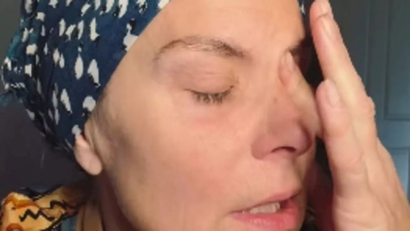 Tracy Shaw shares emotional video on commencing chemotherapy for breast cancer