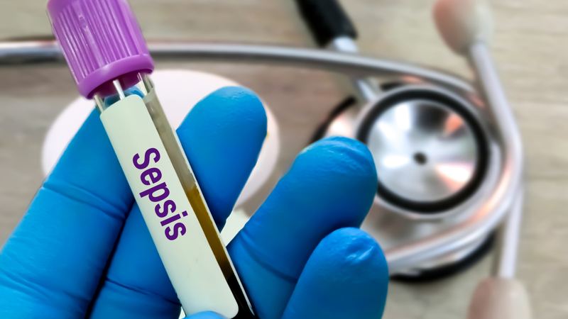 NASCAR driver’s death brings attention to sepsis; postpartum cardiovascular care; Ebola treatment; plus other stories with Vanderbilt Health sources