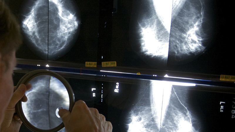 National Cancer Survivors Day highlights life after treatment